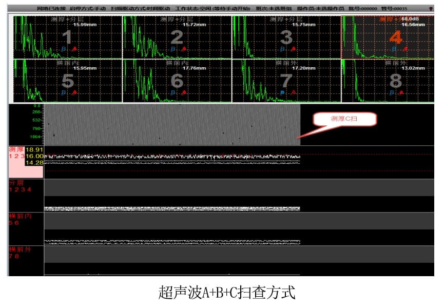 超聲波掃查界面